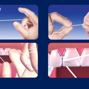 چگونه نخ دندان بکشیم؟