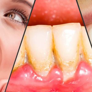 اول مسواک بزنیم یا نخ دندان؟