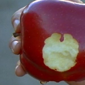 درمان فاصله بین دندان ها