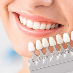 زیباسازی دندان | لمینت دندان | شرکت ستاره گنبد مینا