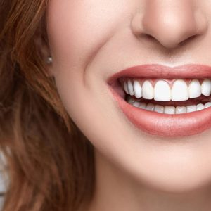 لبخند زیبا با دندان های سفید و مرتب | نخ دندان مینا