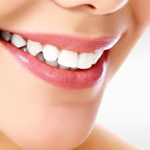 بلیچینگ یا سفید کردن دندان | نخ دندان مینا