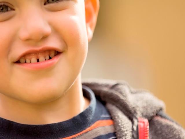 وجود فاصله بین دندان ها | شرکت ستاره گنبد مینا