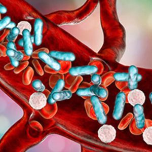 بیماری سپسیس | شرکت ستاره گنبد مینا