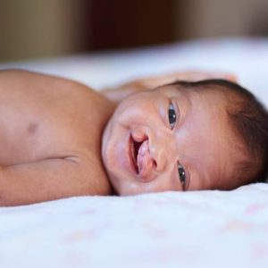 روش های درمان شکاف کام و لب | شرکت نخ دندان مینا