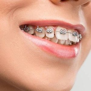 | شرکت نخ دندان مینا