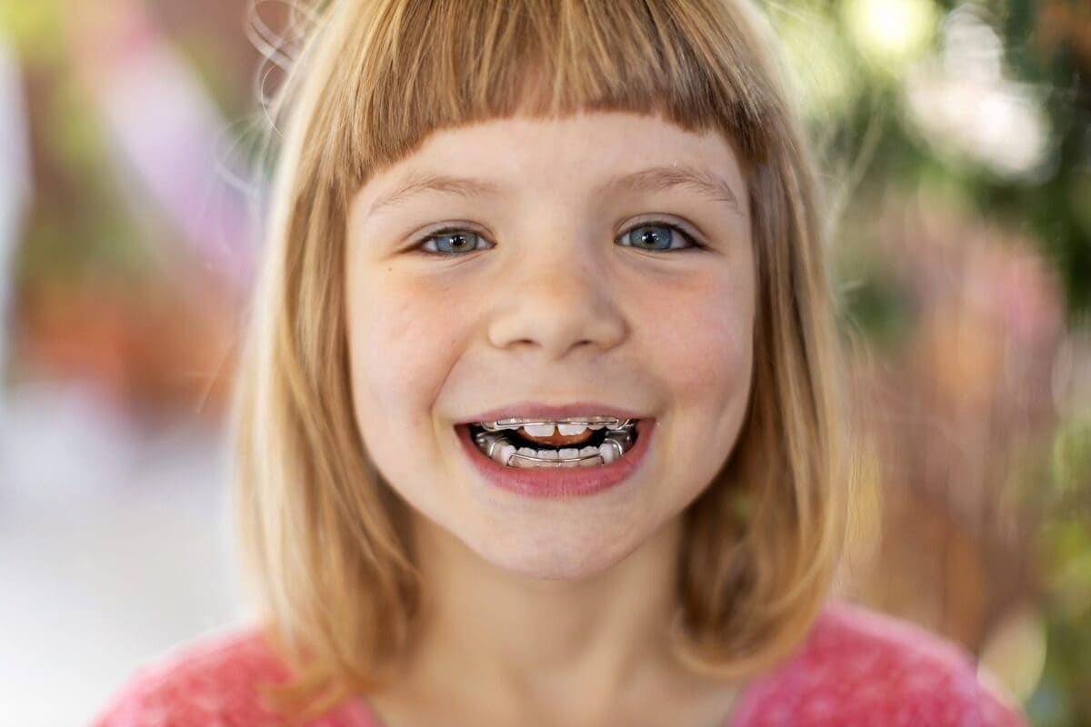 فواید ارتودنسی | نخ دندان مینا