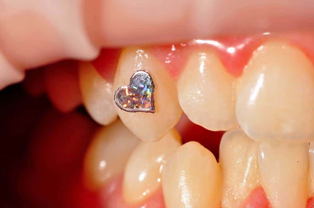 عوارض جواهرات دهان | نخ دندان مینا