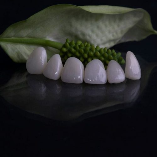 کامپوزیت دندان چیست | نخ دندان مینا