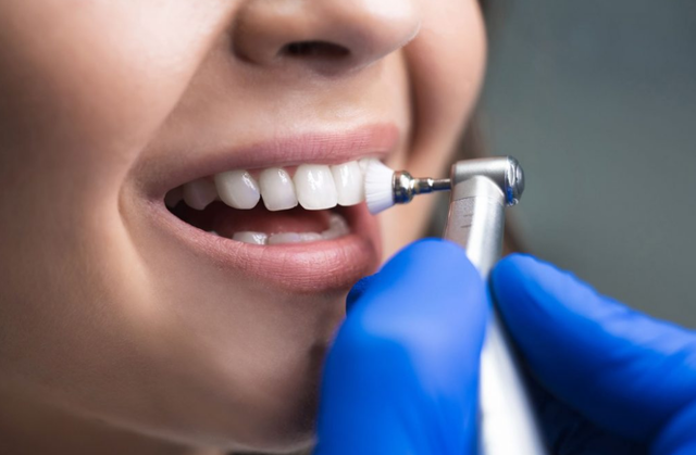 مراقبت‌های پس از بروساژ  | نخ دندان مینا