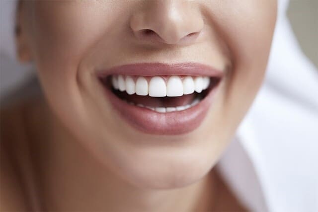  لومینیرز دندان چه تفاوتی با دیگر روکش‌ها دارد؟ | نخ دندان مینا