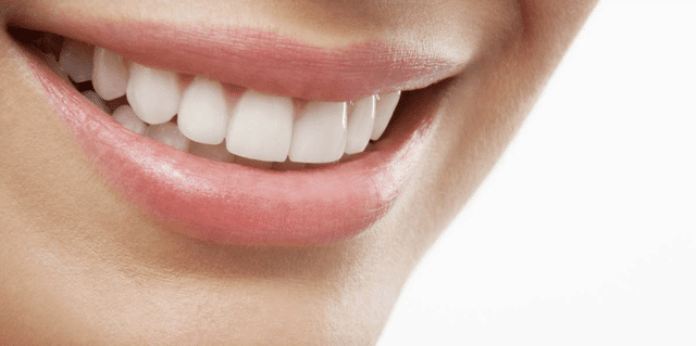 مقایسه لومینیرز دندان با لمینت از نظر مواد و ترکیبات سازنده | نخ دندان مینا