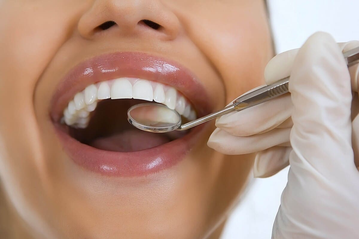 اهمیت چکاپ دندان | نخ دندان مینا